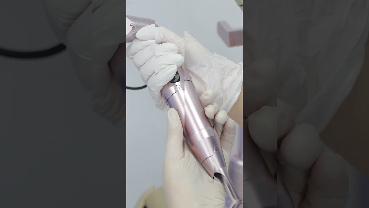 Laser tattoo verwijderen Picolaser Iris