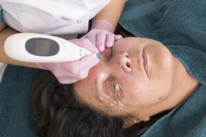 E-book fibroblasting plasmalift