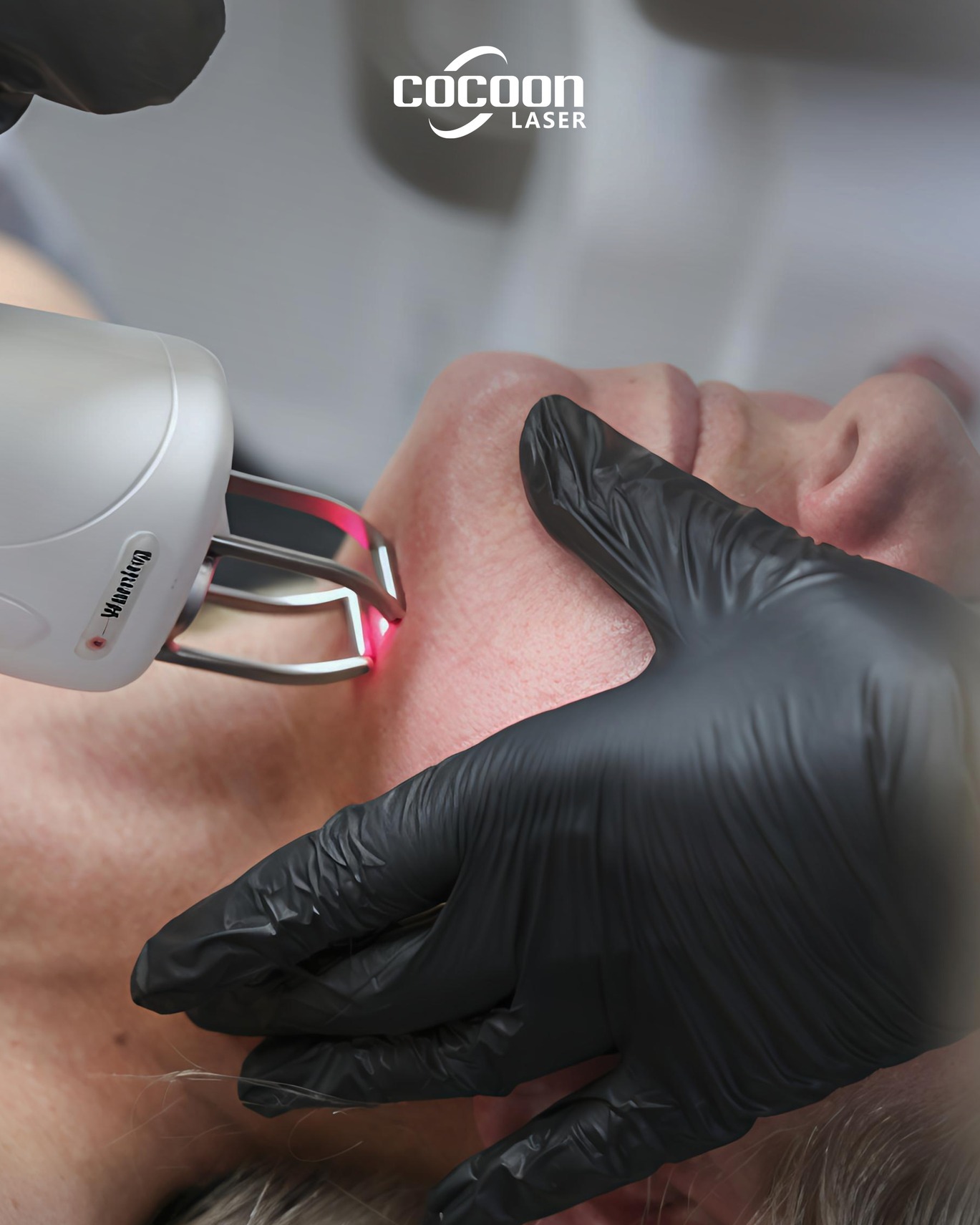 Lav Duel Laser | Huidverbetering en verstrakking - Afbeelding 7