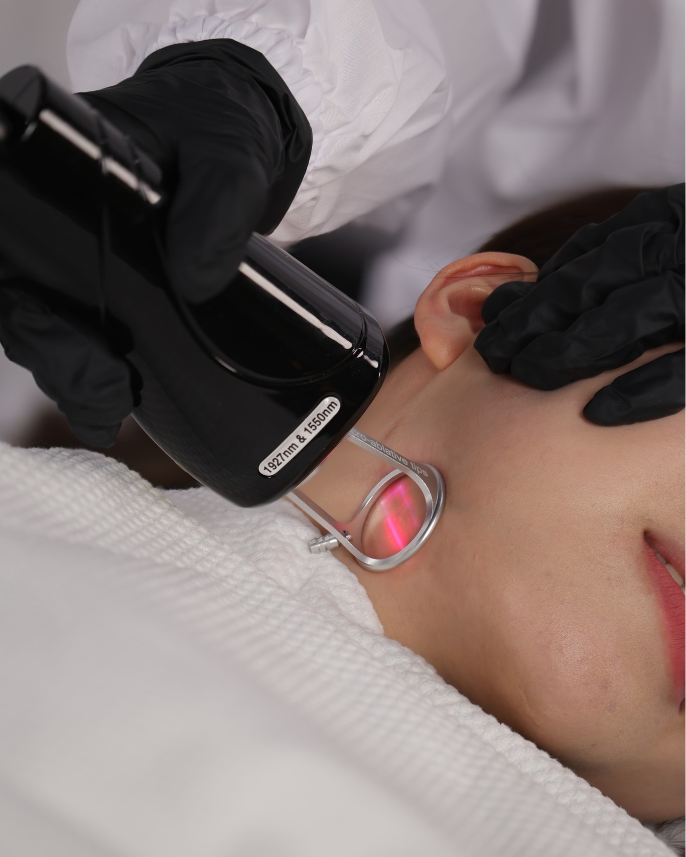 Lav Duel Laser | Huidverbetering en verstrakking - Afbeelding 12