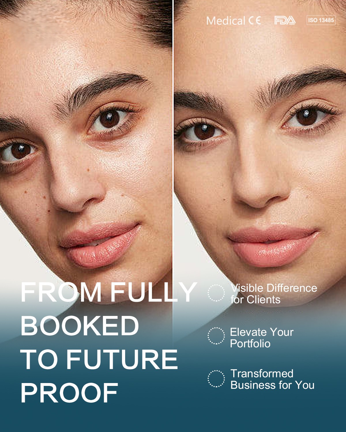 Lav Duel Laser | Huidverbetering en verstrakking - Afbeelding 14