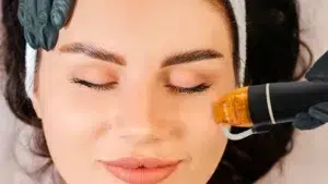 E-book microneedling